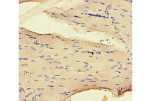 Immunohistochemistry of paraffin-embedded human skeletal muscle tissue using ABIN7161435 at dilution of 1:100 (NRP2 antibody  (AA 60-209))