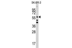 Image no. 1 for anti-Aldehyde Dehydrogenase 5 Family, Member A1 (ALDH5A1) (C-Term) antibody (ABIN356986) (ALDH5A1 antibody  (C-Term))