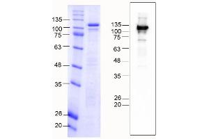 K-Cadherin (CDH6) (AA 54-615), Fraction 7-8 (CDH6 Protein (AA 54-615) (MBP tag))