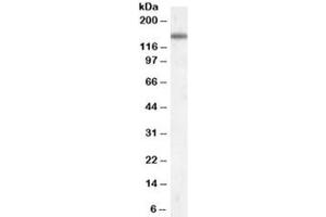 Western blot testing of rat spinal cord lysate with CILP antibody at 0. (CILP antibody)