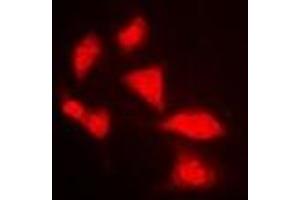 Immunofluorescent analysis of APOBEC3G staining in MCF7 cells. (APOBEC3G antibody)