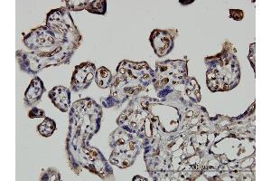 Immunoperoxidase of monoclonal antibody to NEDD1 on formalin-fixed paraffin-embedded human placenta. (NEDD1 antibody  (AA 561-660))