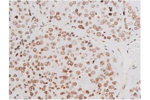 Immunohistochemistry (IHC) image for anti-Nuclear Factor-kB p65 (NFkBP65) (pThr435) antibody (ABIN6255688)