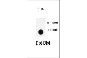 Dot blot analysis of anti-Phospho-GIT1-p Antibody (ABIN389936 and ABIN2839750) on nitrocellulose membrane. (GIT1 antibody  (pTyr554))