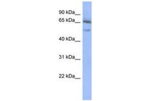 Image no. 1 for anti-Nuclear Factor of kappa Light Polypeptide Gene Enhancer in B-Cells Inhibitor, epsilon (NFKBIE) (AA 431-480) antibody (ABIN6742773) (NFKBIE antibody  (AA 431-480))