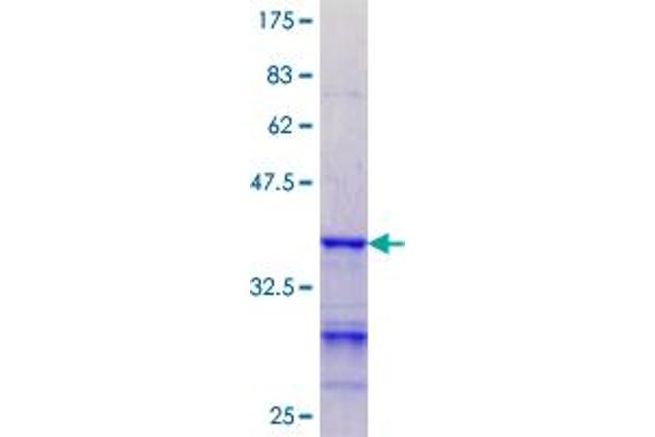 HLA-DOA Protein (AA 28-125) (GST tag)