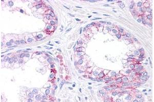 Human Prostate: Formalin-Fixed, Paraffin-Embedded (FFPE) (CEBPA antibody  (AA 288-337))