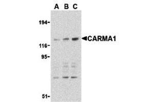 Western Blotting (WB) image for anti-Caspase Recruitment Domain Family, Member 11 (CARD11) (C-Term) antibody (ABIN1030313) (CARD11 antibody  (C-Term))