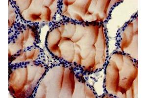 Immunohistochemistry of paraffin-embedded human thyroid tissue using ABIN7163564 at dilution of 1:100 (Plastin 3 antibody  (AA 310-455))