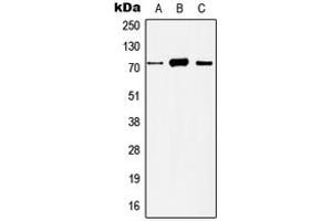Western blot analysis of Histone Deacetylase 10 expression in HeLa (A), Jurkat (B), mouse liver (C), rat liver (D) whole cell lysates. (HDAC10 antibody  (N-Term))