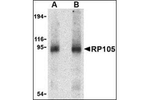 Western blot analysis of RP105 in human spleen tissue lysate with this product at (A) 0. (CD180 antibody  (Center))