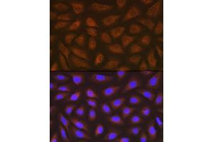 Immunofluorescence analysis of U-2 OS cells using eEF2 Rabbit mAb (ABIN7267025) at dilution of 1:100 (40x lens). (EEF2 antibody)