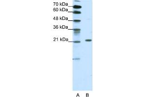 WB Suggested Anti-CBX1 Antibody Titration:  1. (CBX1 antibody  (Middle Region))