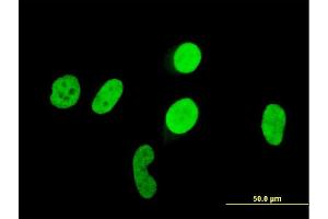 Immunofluorescence of monoclonal antibody to RUNX1 on HeLa cell. (RUNX1 antibody  (AA 210-310))