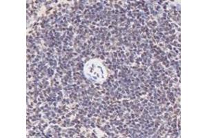 Immunohistochemistry (Paraffin-embedded Sections) (IHC (p)) image for anti-Polyglutamine Binding Protein 1 (PQBP1) antibody (ABIN7075126)