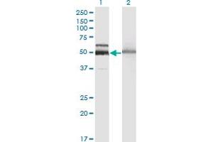 Western Blot analysis of HEXA expression in transfected 293T cell line by HEXA monoclonal antibody (M06A), clone 3D1. (Hexosaminidase A antibody  (AA 1-529))