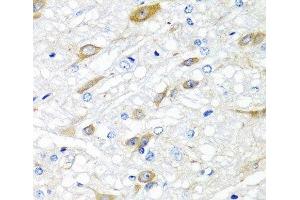Immunohistochemistry of paraffin-embedded Rat brain using CPA6 Polyclonal Antibody at dilution of 1:100 (40x lens). (CPA6 antibody)