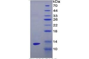 SDS-PAGE of Protein Standard from the Kit (Highly purified E. (ENO1 ELISA Kit)