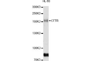 Western blot analysis of extracts of HL-60 cells, using CFTR antibody (ABIN5974674) at 1/1000 dilution. (CFTR antibody)