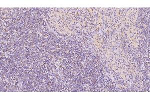 Immunohistochemistry (IHC) image for anti-Annexin A5 (ANXA5) (AA 1-320) antibody (ABIN7425791)