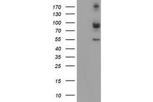 HEK293T cells were transfected with the pCMV6-ENTRY control (Left lane) or pCMV6-ENTRY CAPN2 (Right lane) cDNA for 48 hrs and lysed. (Calpain 2 antibody)