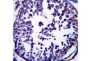 RAB5C antibody immunohistochemistry analysis in formalin fixed and paraffin embedded human testis tissue. (Rab5c antibody  (AA 178-207))