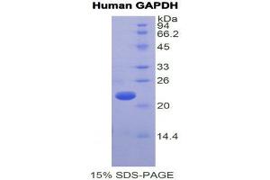 SDS-PAGE (SDS) image for Glyceraldehyde-3-Phosphate Dehydrogenase (GAPDH) (AA 154-324) protein (His tag) (ABIN2121141) (GAPDH Protein (AA 154-324) (His tag))
