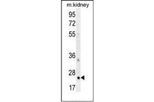 Western blot analysis of HOXB6 / HOX2B Antibody (Center) in mouse kidney tissue lysates (35ug/lane). (HOXB6 antibody  (Middle Region))