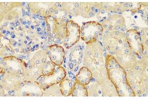 Immunohistochemistry of paraffin-embedded Rat kidney using MT1-MMP Polyclonal Antibody at dilution of 1:100 (40x lens). (MMP14 antibody)