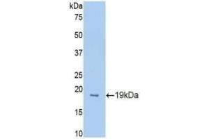 Detection of Recombinant PROCR, Mouse using Polyclonal Antibody to Endothelial protein C receptor (EPCR) (PROCR antibody  (AA 32-167))