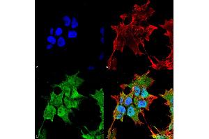 Immunocytochemistry/Immunofluorescence analysis using Mouse Anti-SUR1 Monoclonal Antibody, Clone S289-16 . (ABCC8 antibody  (AA 1548-1582) (Atto 594))