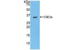 Western blot analysis of recombinant Mouse ITGb1. (ITGB1 antibody  (AA 454-714))