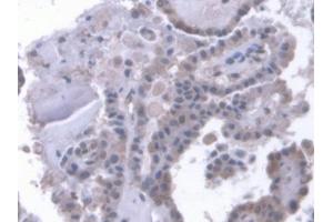 DAB staining on IHC-P; Samples: Human Thyroid Tissue (LRP1B antibody  (AA 31-194))
