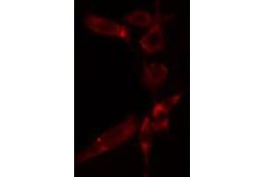 ABIN6277280 staining  HuvEc cells by IF/ICC. (AIF antibody  (C-Term))
