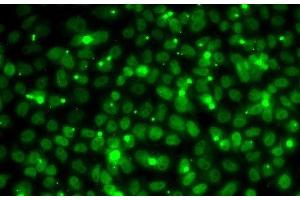 Immunofluorescence analysis of MCF7 cells using RPA3 Polyclonal Antibody (RPA3 antibody)
