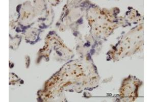 Image no. 1 for anti-Exosome Component 8 (EXOSC8) (AA 1-277) antibody (ABIN599183) (EXOSC8 antibody  (AA 1-277))