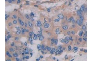 Immunohistochemistry (IHC) image for anti-Filamin C, gamma (FLNC) (AA 17-259) antibody (ABIN7441958)