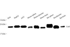 Western blot analysis of LITAF (ABIN7074508),at dilution of 1: 2000 (LITAF antibody)