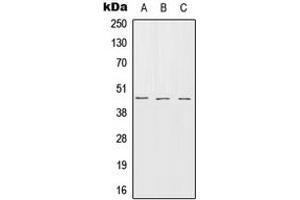 Western blot analysis of Serpin B7 expression in HEK293T (A), SP2/0 (B), rat brain (C) whole cell lysates. (SERPINB7 antibody  (Center))