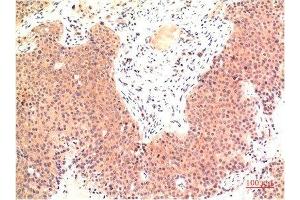 Immunohistochemical analysis of paraffin-embedded Human Colon Carcinoma Tissue using Epsilon Tubulin Mouse mAb diluted at 1:200. (TUBE1 antibody)