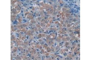Immunohistochemistry (IHC) image for anti-alpha-2-Macroglobulin (A2M) (AA 574-734) antibody (ABIN1857847)