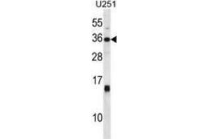 Western blot analysis in U251 cell line lysates (35ug/lane) using Stanniocalcin-1 / STC1 Antibody (C-term). (Stanniocalcin 1 antibody  (C-Term))