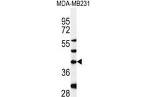 Western Blotting (WB) image for anti-Dolichyl-Phosphate (UDP-N-Acetylglucosamine) N-acetylglucosaminephosphotransferase 1 (GlcNAc-1-P Transferase) (DPAGT1) antibody (ABIN3004399) (DPAGT1 antibody)