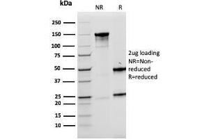 SDS-PAGE Analysis Purified LMO2 Mouse Monoclonal Antibody (rLMO2/1971). (Recombinant LMO2 antibody  (AA 23-140))