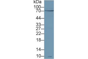 Detection of zAP70 in Human Jurkat cell lysate using Polyclonal Antibody to Zeta Chain Associated Protein Kinase 70 kDa (zAP70) (ZAP70 antibody  (AA 337-600))