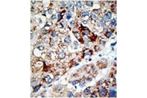 Image no. 2 for anti-Ubiquitin Specific Peptidase 21 (USP21) (N-Term) antibody (ABIN356603) (USP21 antibody  (N-Term))