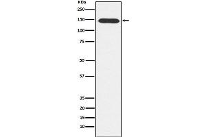 Western blot analysis of PLCB3 expression in A431 cell lysate.