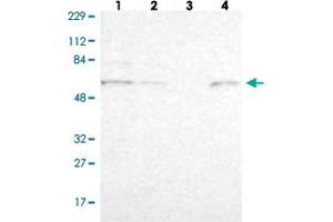 Western blot analysis of Lane 1: Human cell line RT-4 Lane 2: Human cell line U-251MG sp Lane 3: Human plasma (IgG/HSA depleted) Lane 4: Human liver tissue with ZNF550 polyclonal antibody .