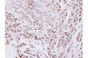 IHC-P Image Immunohistochemical analysis of paraffin-embedded MDAMB-468 xenograft, using CIP29, antibody at 1:100 dilution. (SARNP antibody)