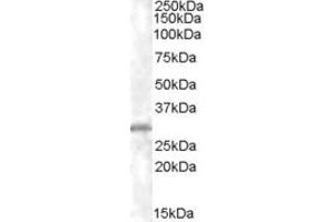 ABIN185381 (xµg/ml) staining of K562 lysate (35µg protein in RIPA buffer). (CHMP5 antibody  (C-Term))